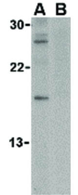 Western Blot of Caspase-14 Antibody