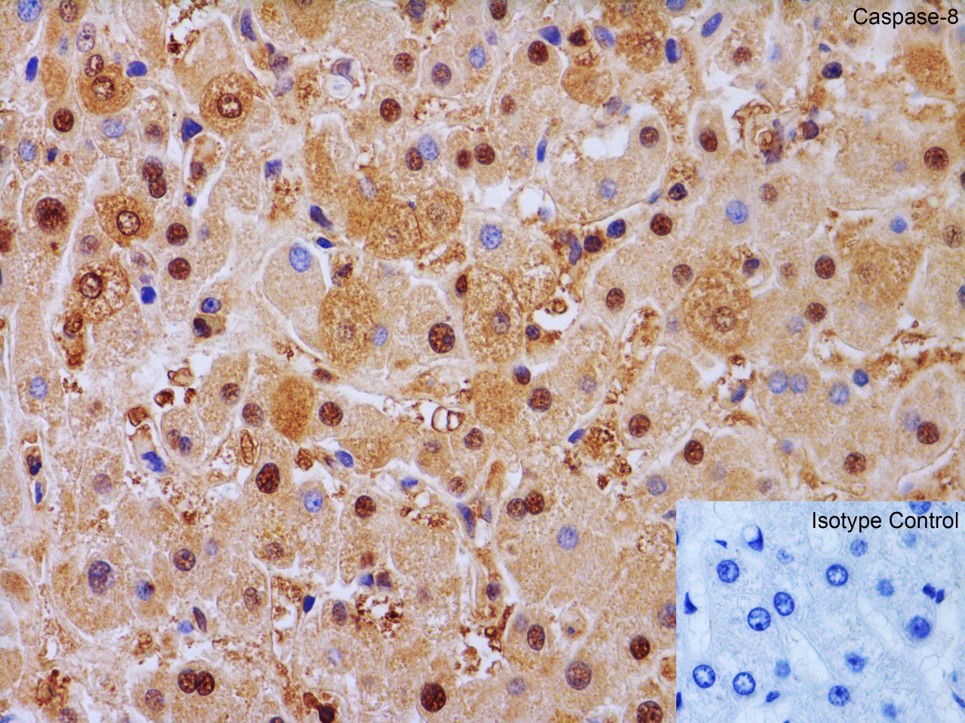 Immunohistochemistry Validation of Caspase-8