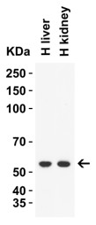 Western Blot using Caspase 8
