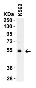 Western Blot using Caspase 8