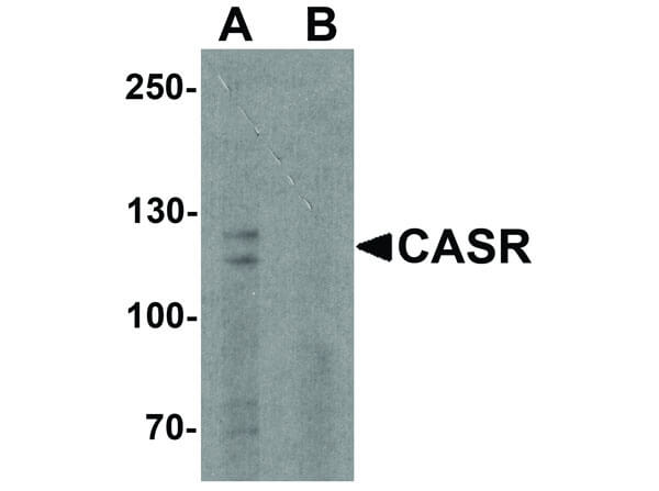 Western Blot of CASR Antibody