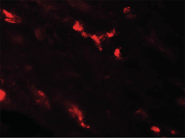 Immunofluorescence of CASR Antibody