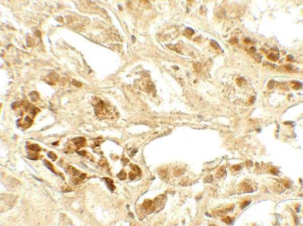 Immunohistochemistry of CASR Antibody