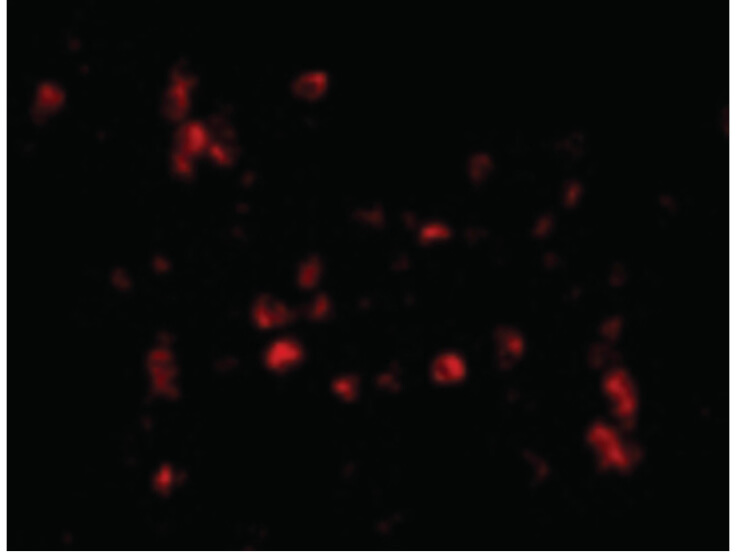 Immunofluorescence of Cathelicidin Antibody