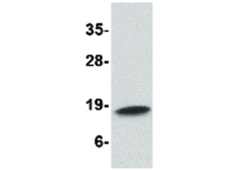 Western Blot of Cathelicidin Antibody