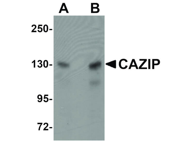 Western Blot of CAZIP Antibody