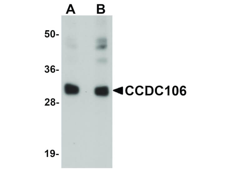 Western Blot of CCDC106 Antibody