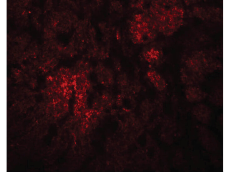 Immunofluorescence of CCDC106 Antibody