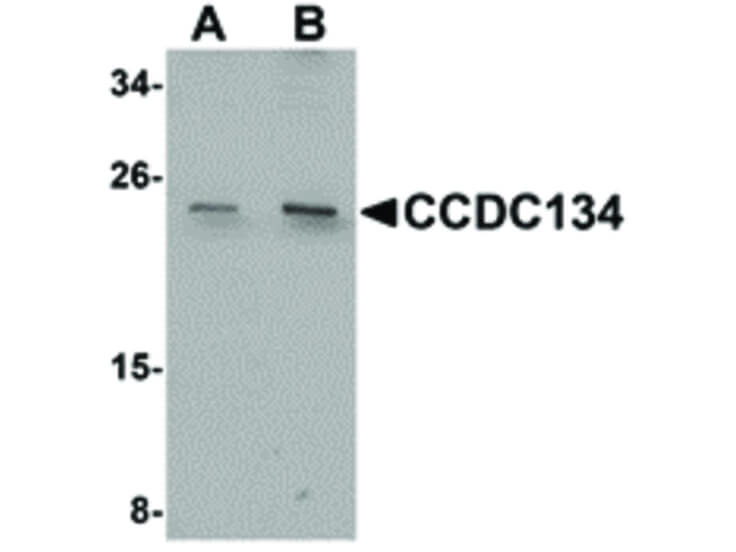 Western Blot of CCDC134 Antibody