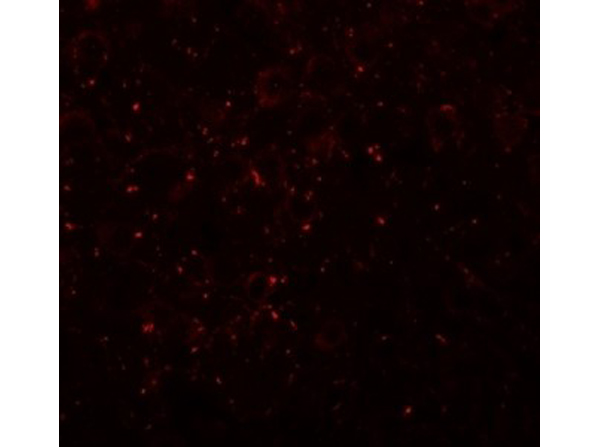 Immunofluorescence of CCDC141
