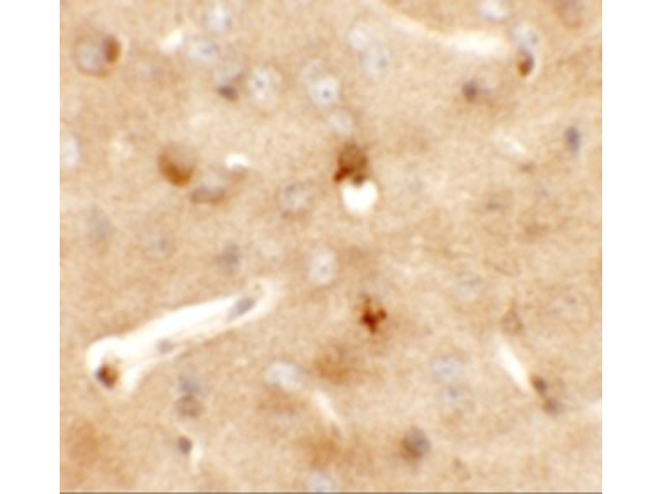 Immunohistochemistry of CCDC141