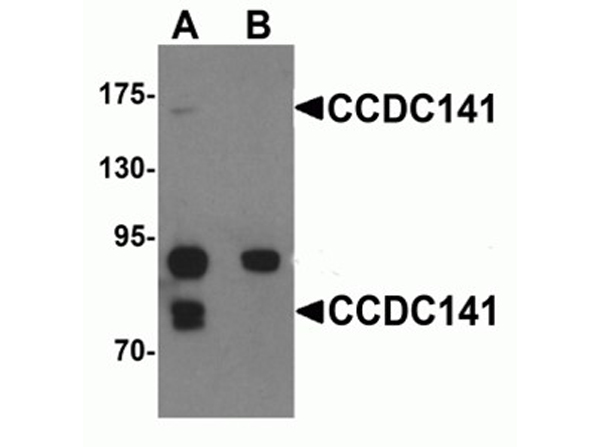 Western blot analysis of CCDC141