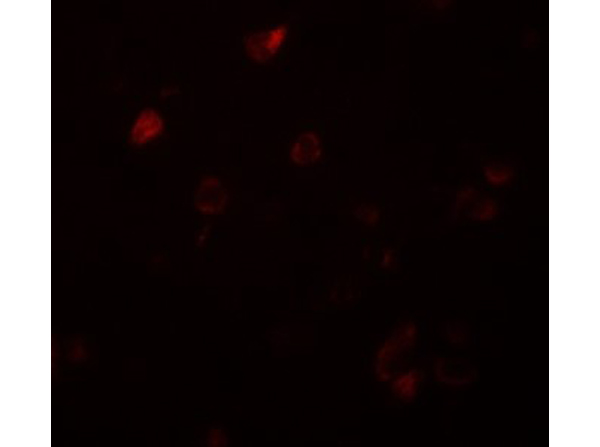 Immunofluorescence of CCDC22