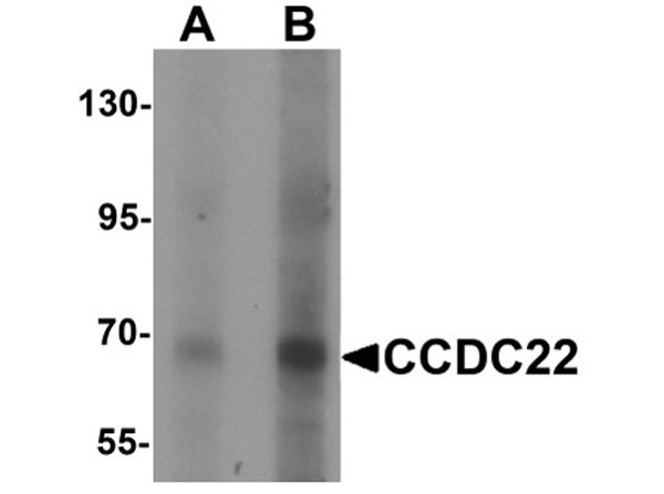 Western blot analysis of CCDC22