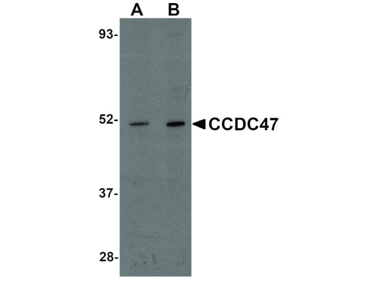 Western Blot of CCDC47 Antibody