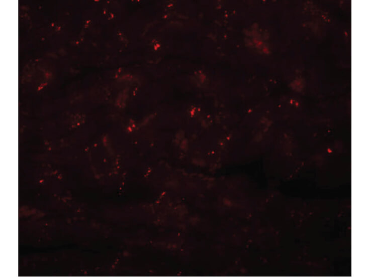 Immunofluorescence of CCDC47 Antibody