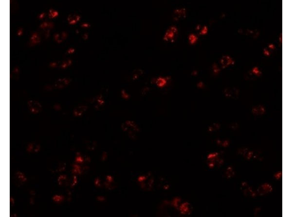 Immunofluorescence of CCL17