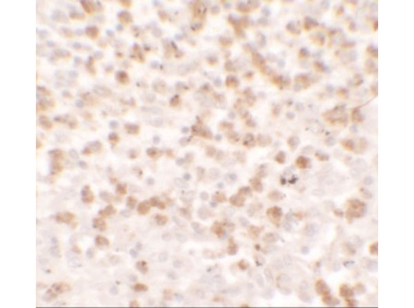 Immunohistochemistry of CCL17