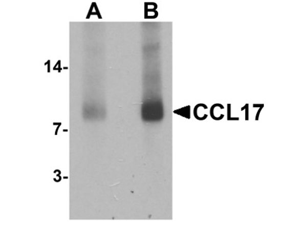 Western blot analysis of CCL17
