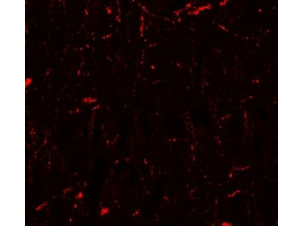 Immunofluorescence of CCNT1