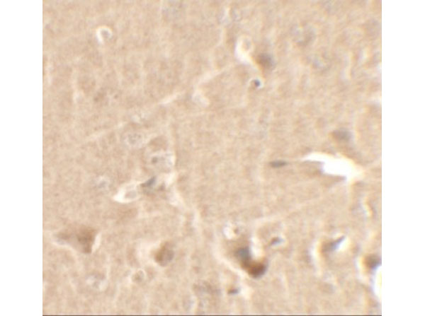 Immunohistochemistry of CCNT1