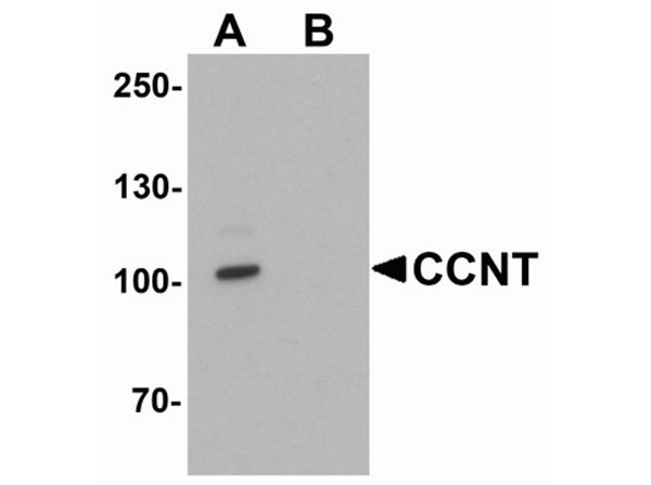 Western blot analysis of CCNT1
