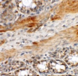 Immunohistochemistry of CCP110