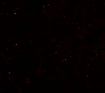 Immunofluorescence of CCP110