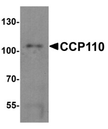 Western blot analysis of CCP110