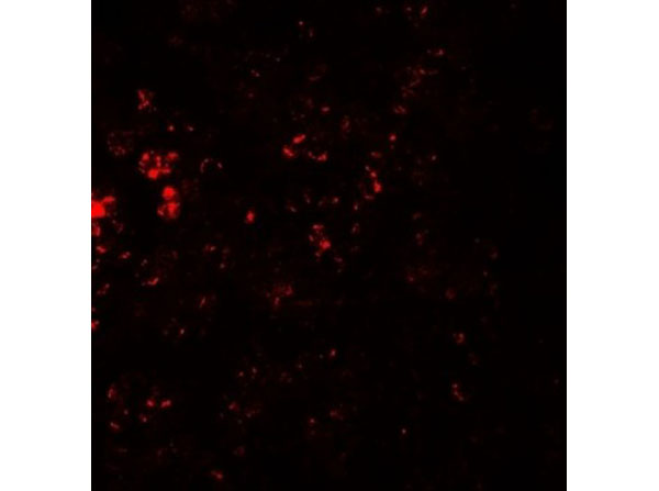 Immunofluorescence of CCR7