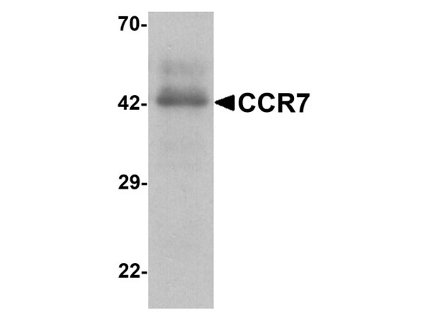Western blot of CCR7