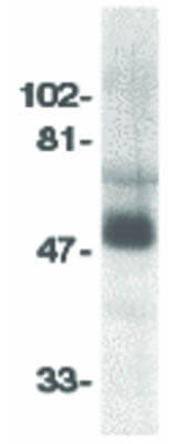Western Blot of CCR8 Antibody