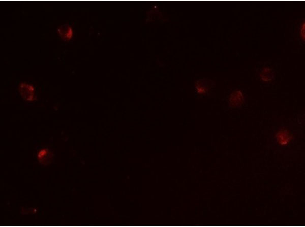 Immunofluorescence of CD160