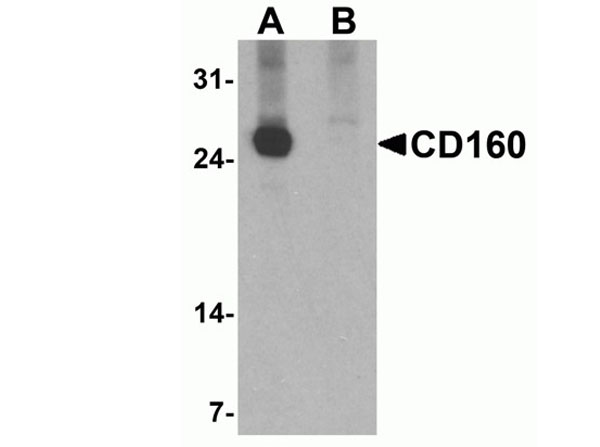 Western blot of CD160