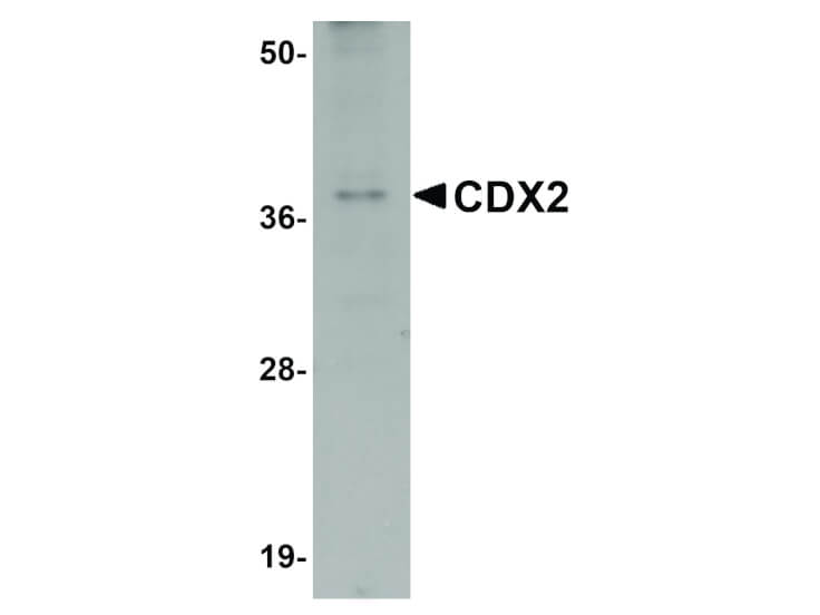 Western Blot of CDX2 Antibody