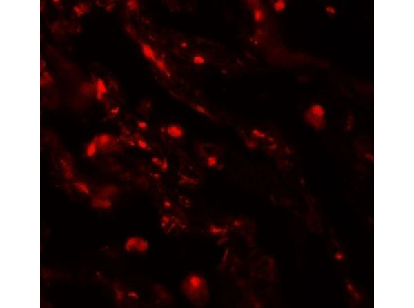 Immunofluorescence of CEACAM5
