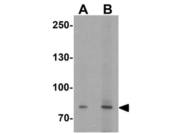 Western blot of CEACAM5