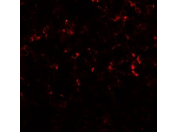 Immunofluorescence of CEBPD