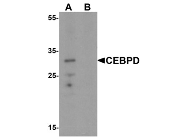 Western blot analysis of CEBPD