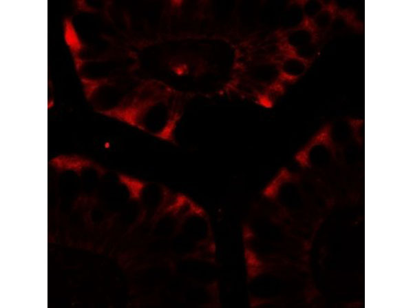 Immunofluorescence of CFTR