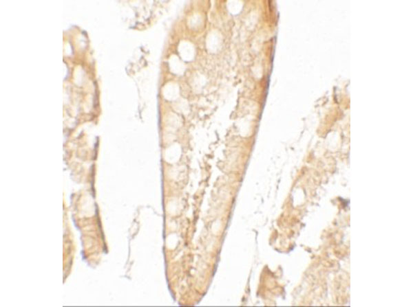 Immunohistochemistry of CFTR