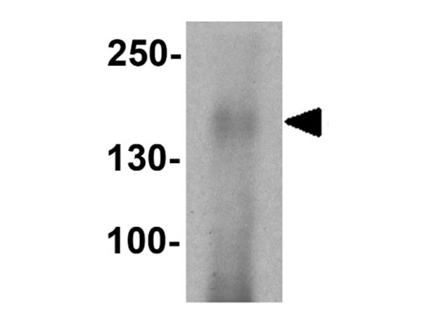 Western blot of CFTR