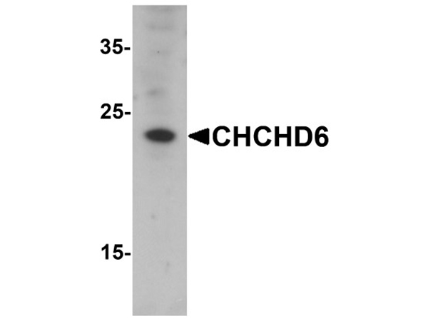 Western blot analysis of CHCHD6