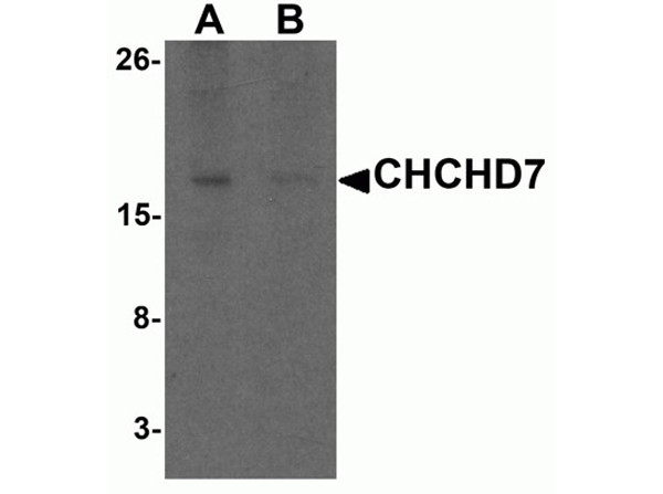 Western blot analysis of CHCHD7
