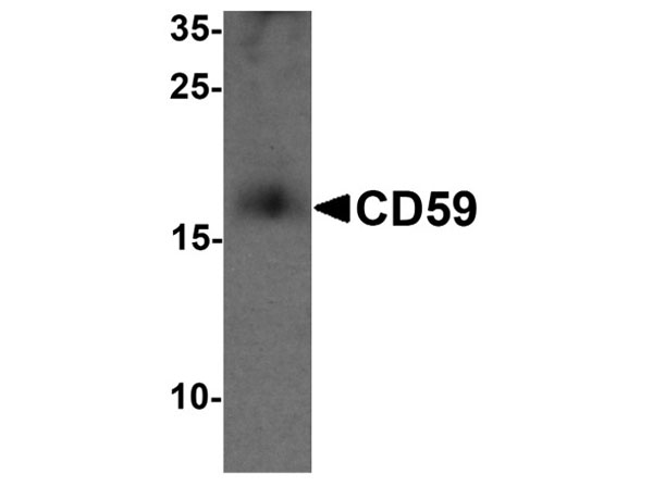 Western blot analysis of CD59