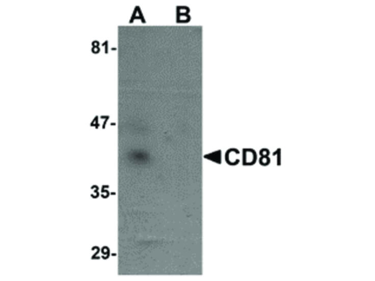 Western Blot of CD81 Antibody