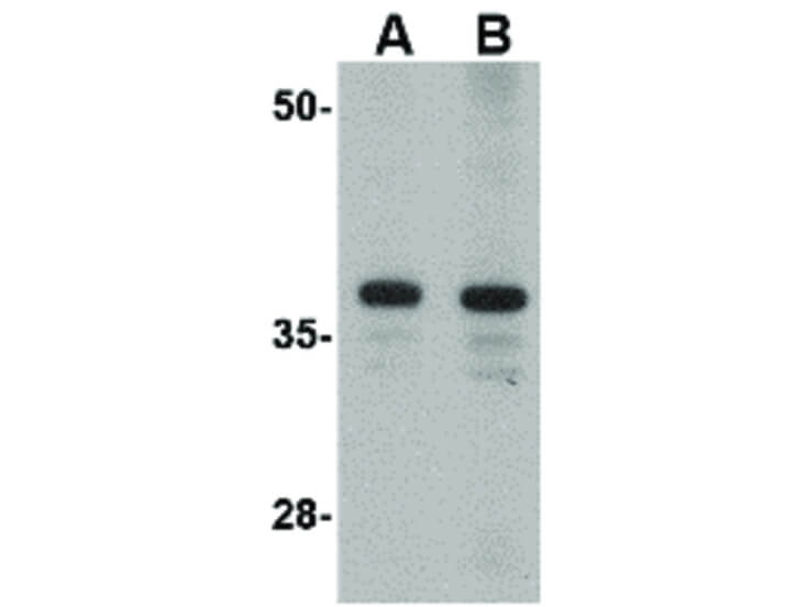 Western Blot of CDCA8 Antibody
