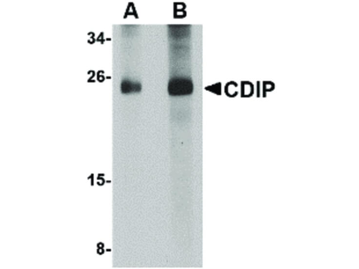 Western Blot of CDIP Antibody