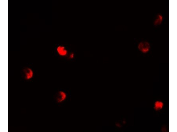 Immunofluorescence of CDKN1C