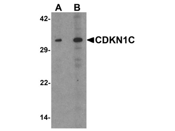 Western blot analysis of CDKN1C
